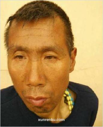 失踪人52岁(目测) 男 无名 智力残疾 在大连市救助站