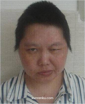 失踪人41岁(目测) 女 无名氏（张小红） 智力残疾|||精神异常 在台州市救助站