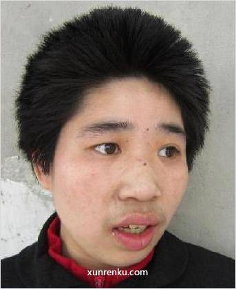 失踪人25岁(目测) 女 061015 智力残疾 在淮安市救助站