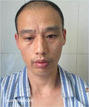 失踪人34岁(目测) 男 B5-12 发色：黑 在邵阳市救助站