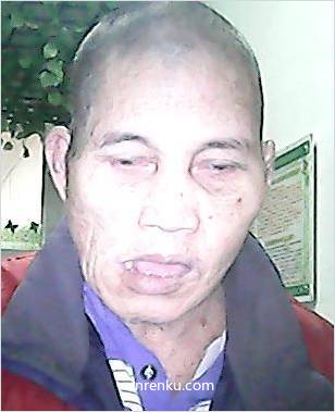 失踪人66岁(目测) 男 救助男100523 精神异常 在桂林市救助站