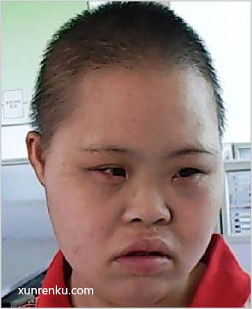 失踪人22岁(目测) 女 罗秋月 智力残疾|||精神异常 在广东省第二救助安置中心