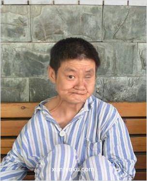 失踪人56岁(目测) 女 无名氏 身体残疾：左侧眼球缺失|||精神异常：入院诊断为：1、待分类的非精神病性障碍 在九龙坡区救助站