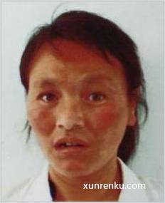 失踪人45岁(目测) 女 东河口57 号 发色：棕 在六安市救助管理站