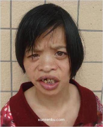 失踪人30岁(目测) 女 无名氏2078 智力残疾 在广东省第一救助中心