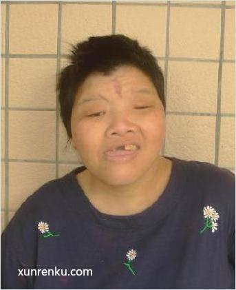 失踪人41岁(目测) 女 无名氏2631 智力残疾：智力障碍 在广东省第一救助中心