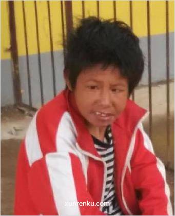 失踪人20岁(目测) 女 无名 智力残疾 在淇县救助站