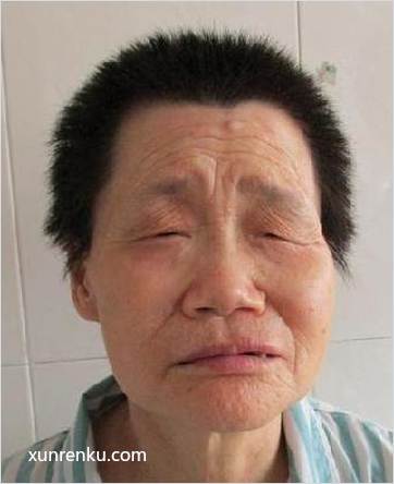 失踪人54岁(目测) 女 助张槎 发色：黑 在佛山市救助站