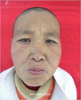 失踪人45岁(目测) 女 无名氏 发色：黑 在天津市救助管理站