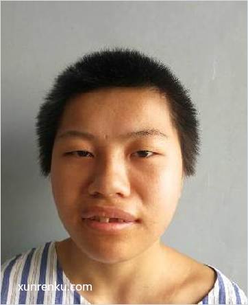失踪人41岁(目测) 女 无名女2 发色：黑 在邵东县救助站