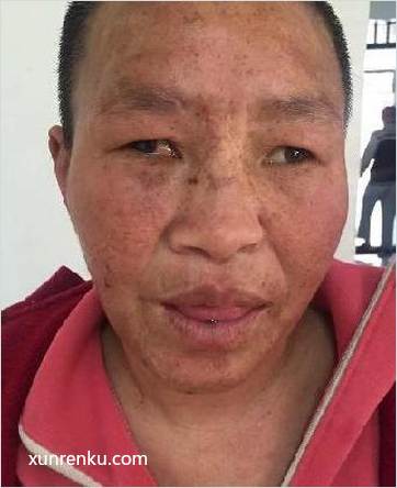失踪人50岁(目测) 女 无名氏 智力残疾 在漯河市救助站