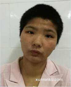 失踪人28岁(目测) 女 无名氏HJA161 发色：黑 在花都区救助站