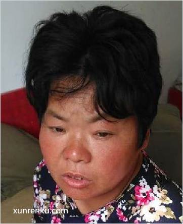 失踪人41岁(目测) 女 无名女 智力残疾 在铜山县救助站