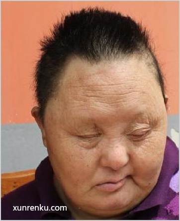 失踪人61岁(目测) 女 民救萍 身体残疾|||智力残疾|||精神异常 在阜阳市救助站
