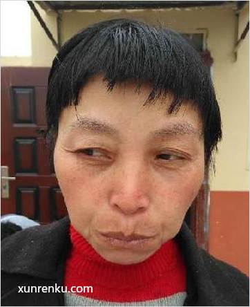 失踪人45岁(目测) 女 无名女 智力残疾 在铜山县救助站