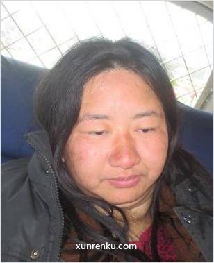 失踪人40岁(目测) 女 亚一 发色：黑 在昌平中西医结合医院