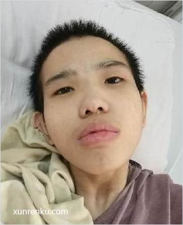 失踪人20岁(目测) 女 无名氏 发色：黑 在广州市救助管理站