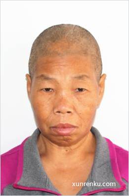 失踪人40岁(目测) 女 丰351 发色：白 在看丹老年公寓
