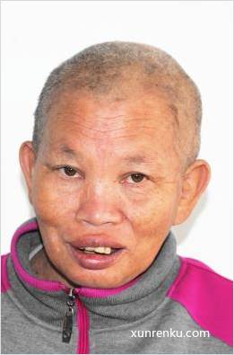 失踪人45岁(目测) 女 顺救55 发色：白 在看丹老年公寓