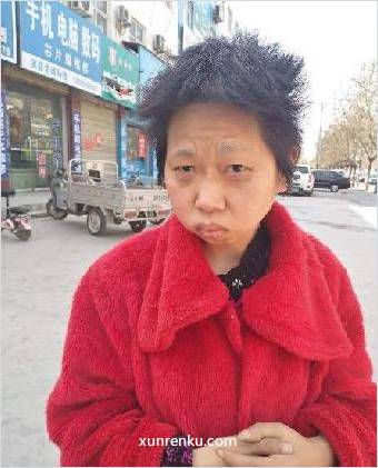 失踪人32岁(目测) 女 无名 智力残疾：智障，不会表达 在淇县救助站