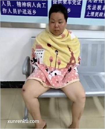 失踪人45岁(目测) 女 无名氏20190608 精神异常 在梧州市救助站