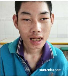 失踪人19岁(目测) 男 关良（樟中木1477） 智力残疾|||精神异常 在广东省第二救助安置中心