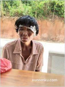 失踪人52岁(目测) 女 无名氏女 发色：黑 在遂溪县救助站
